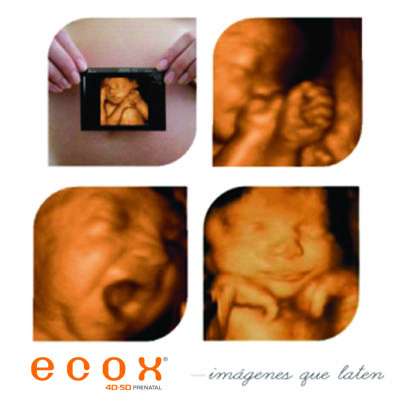 Ecografía emocional: ilusión y ternura