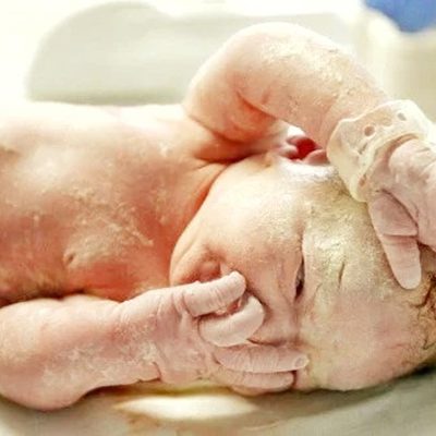 ¿Qué es la capa blanca del bebé?